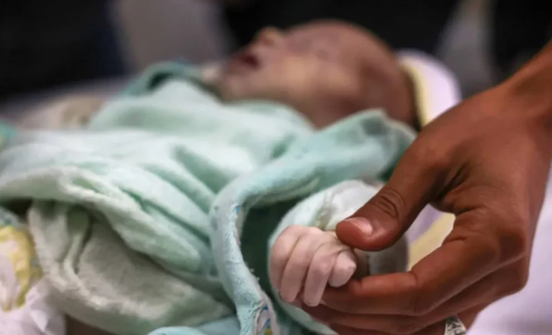 4 حالات وفاة نتيجة المجاعة في قطاع غزة خلال 24 ساعة 4 حالات وفاة نتيجة المجاعة في قطاع غزة خلال 24 ساعة