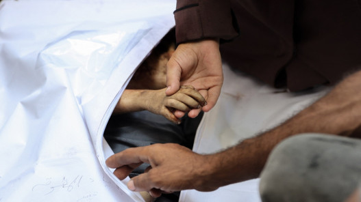 صحة غزة: 7 وفيات جديدة بينهم طفلان نتيجة سوء التغذية والمجاعة​ 