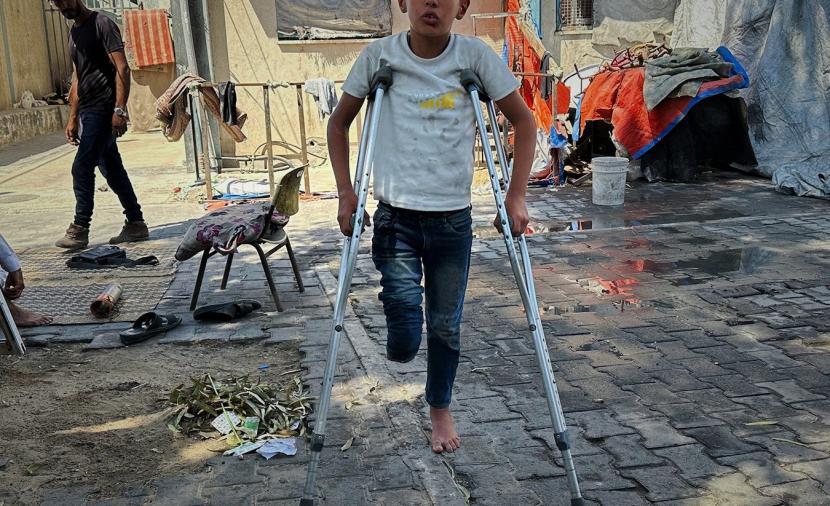غزة تسجّل أعلى معدل لبتر الأطراف لدى الأطفال​ 