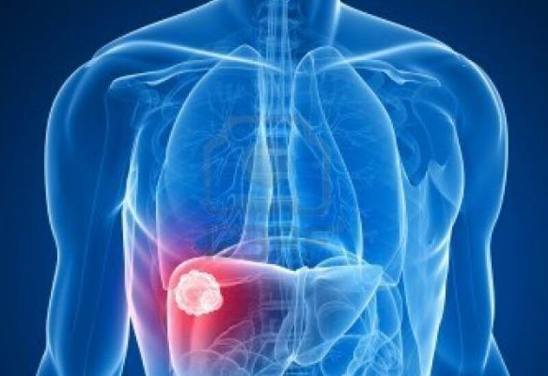 5 علامات صامتة تنذر بمشكلة صحية خطيرة