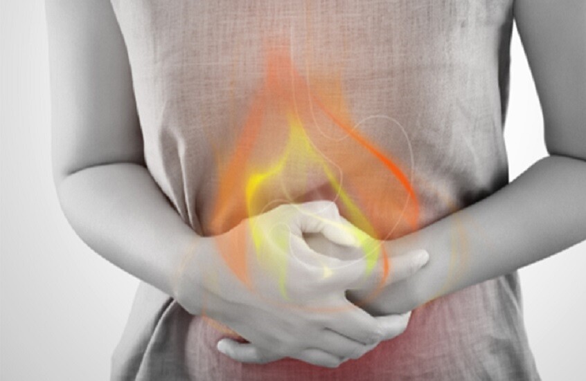 كيفية التخلص من حرقة المعدة المستمرة دون أدوية كيفية التخلص من حرقة المعدة المستمرة دون أدوية